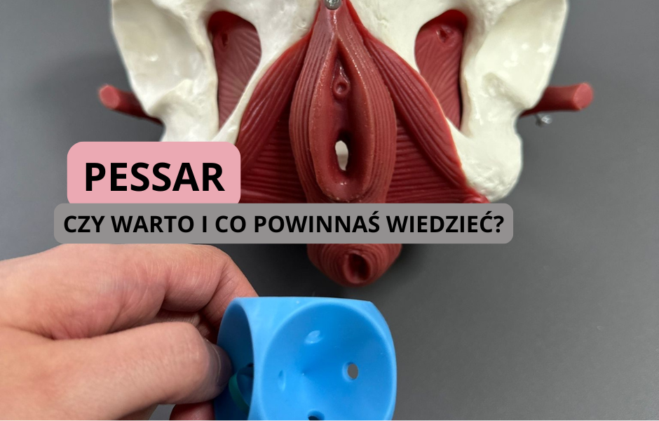 Czym są pessary?